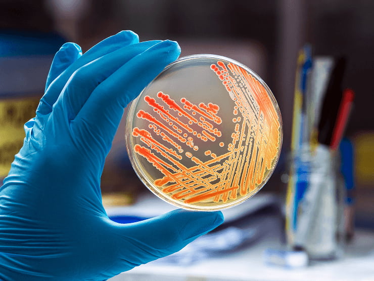 colonies-bacteria-gram-negative-bacilli-gram-negative-cocco-bacilli 1 (1)